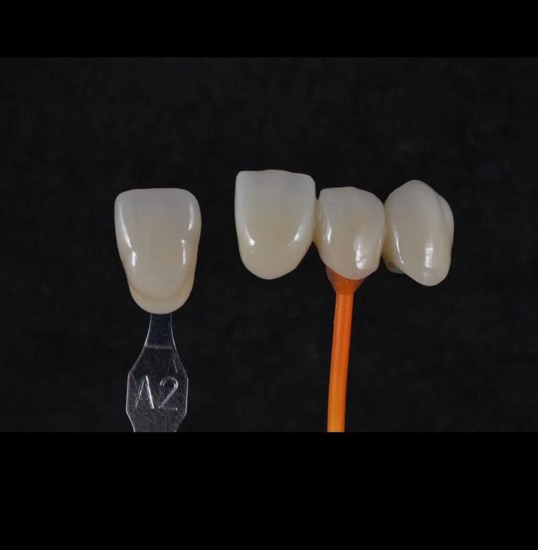 3D Pro Zirconia răng trắng CAD CAM Block 98/95/92mm Hệ thống mở CE