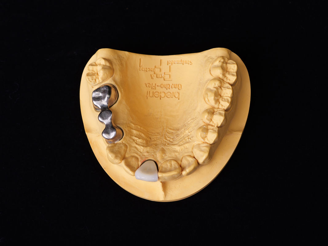 Audental 04 hợp kim quý bạc-Palladium gốm sứ hợp kim trắng Pd53.3% cho phục hồi răng lâu dài