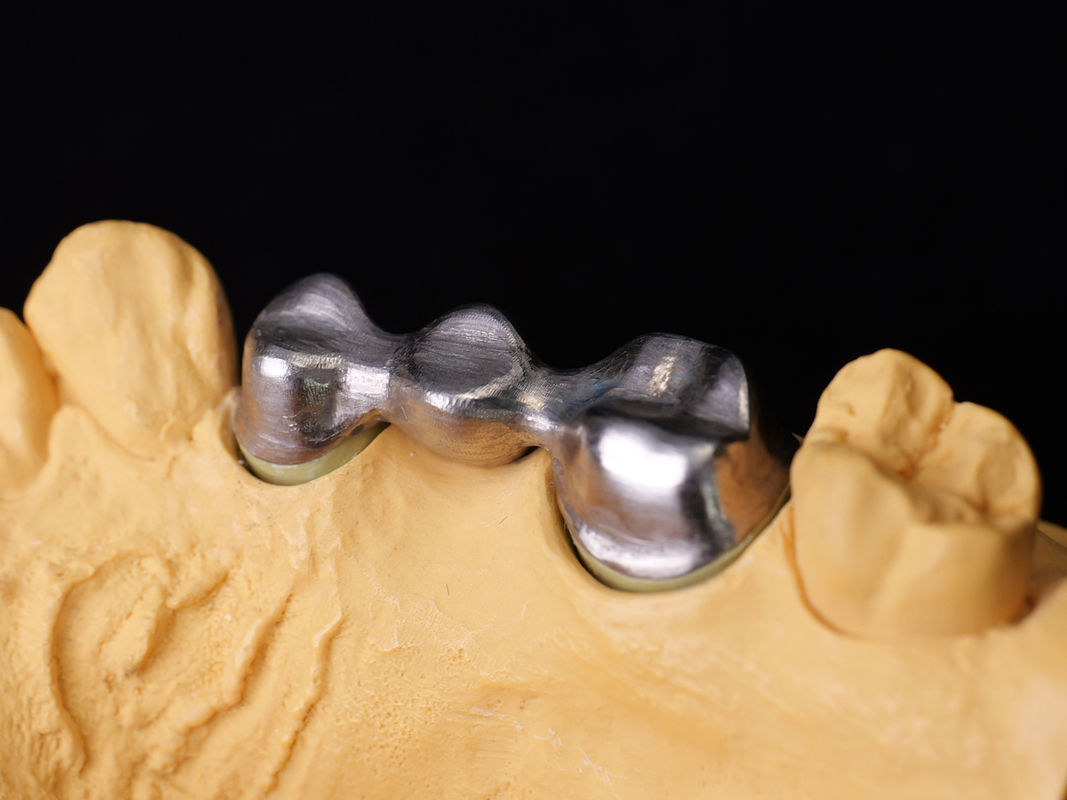 Audental 04 hợp kim quý bạc-Palladium gốm sứ hợp kim trắng Pd53.3% cho phục hồi răng lâu dài
