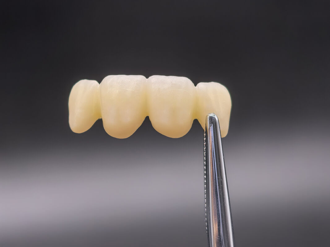 Dental Zirconia Block cung cấp thiết kế gradient tiên tiến và tính ổn định hóa học cho hiệu suất trong chế tạo răng CAD CAM chính xác