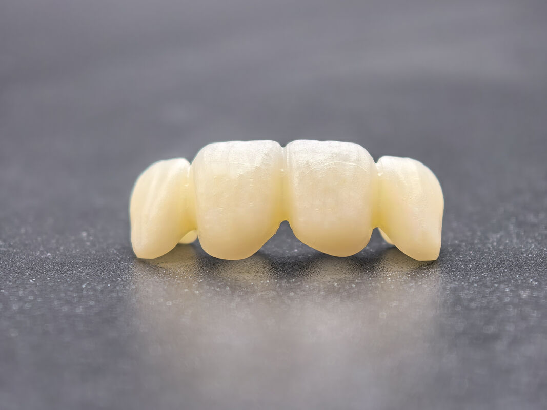 Dental Zirconia Block cung cấp thiết kế gradient tiên tiến và tính ổn định hóa học cho hiệu suất trong chế tạo răng CAD CAM chính xác