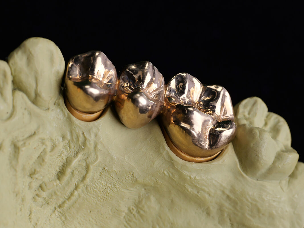 Dental Alloys Crown and Bridge Material with Precise Composition of Gold Platinum Silver and Zinc for Dental Prosthetics